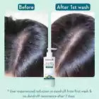 WishCare Hydrating AHA BHA Anti Dandruff Shampoo 250ml