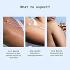 Be Bodywise Pigmentation Cream 100gm | 2.5% Lactic Acid, 2% Urea, Retinol
