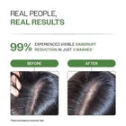 Bare Anatomy Anti Dandruff Shampoo 100ml Women & Men