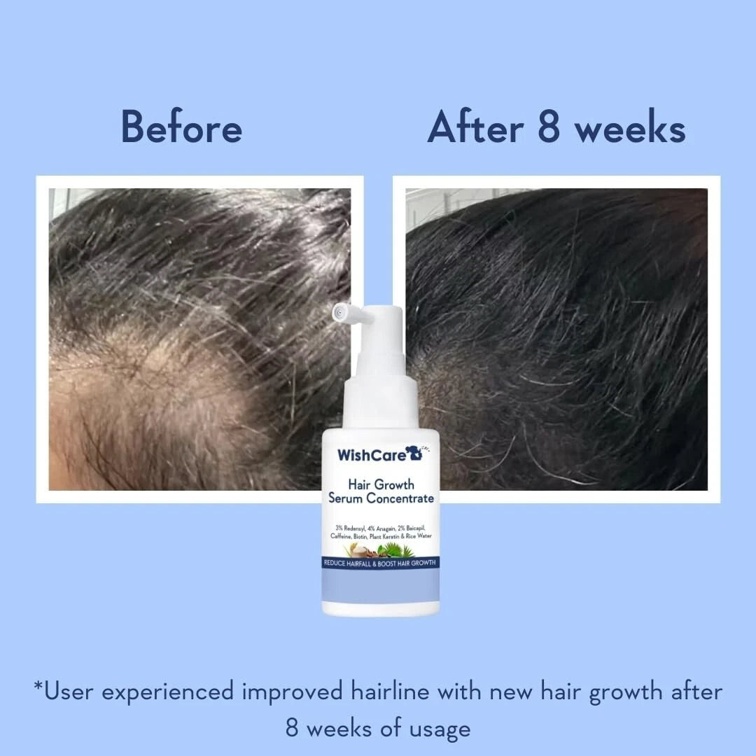 Share WishCare Hair Growth Serum Concentrate with Plant Keratin & Rice Water etc. 30ml