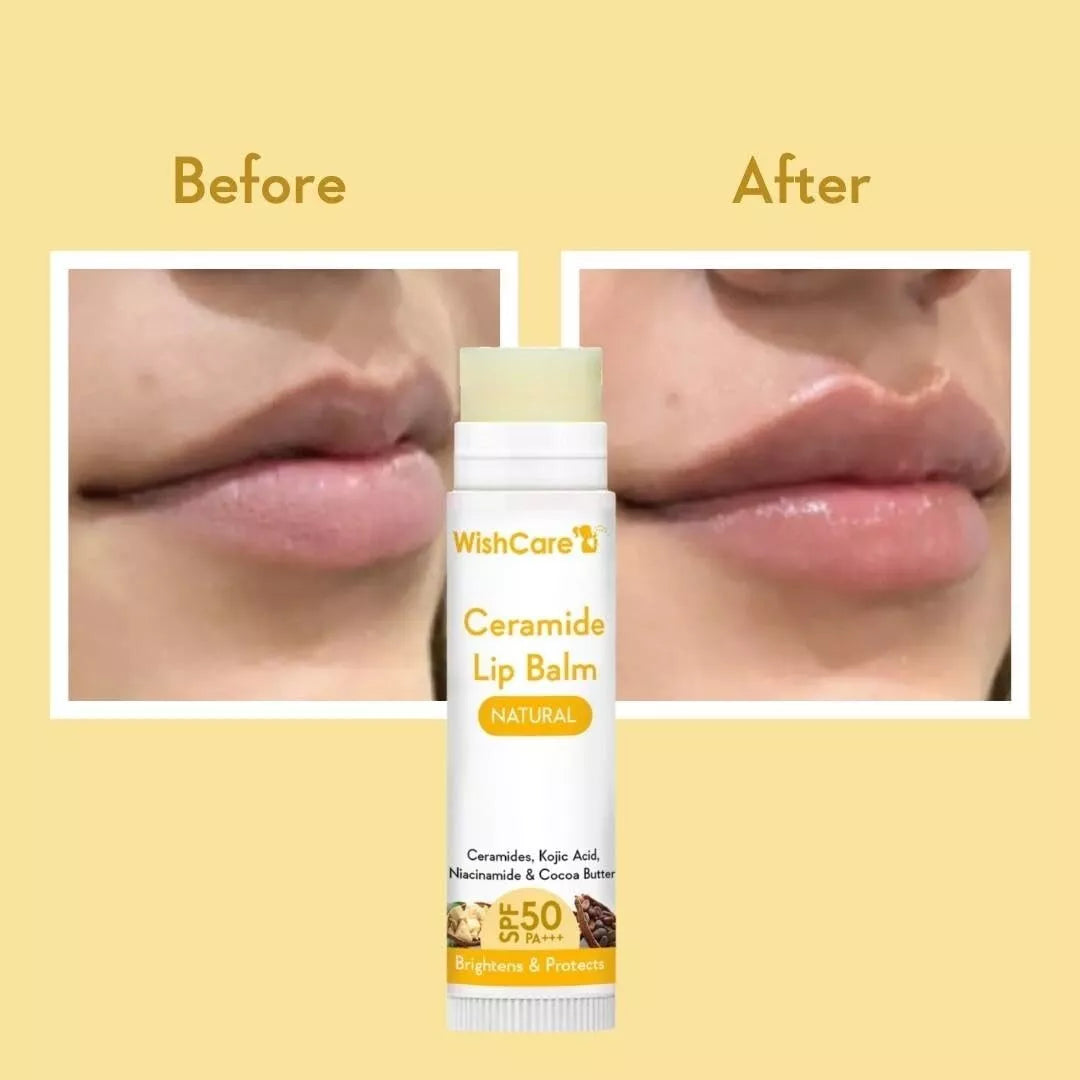 WishCare Ceramide Lip Balm with SPF50 PA++ – Moisturizing & Lightening Formula with Kojic Acid (5g)