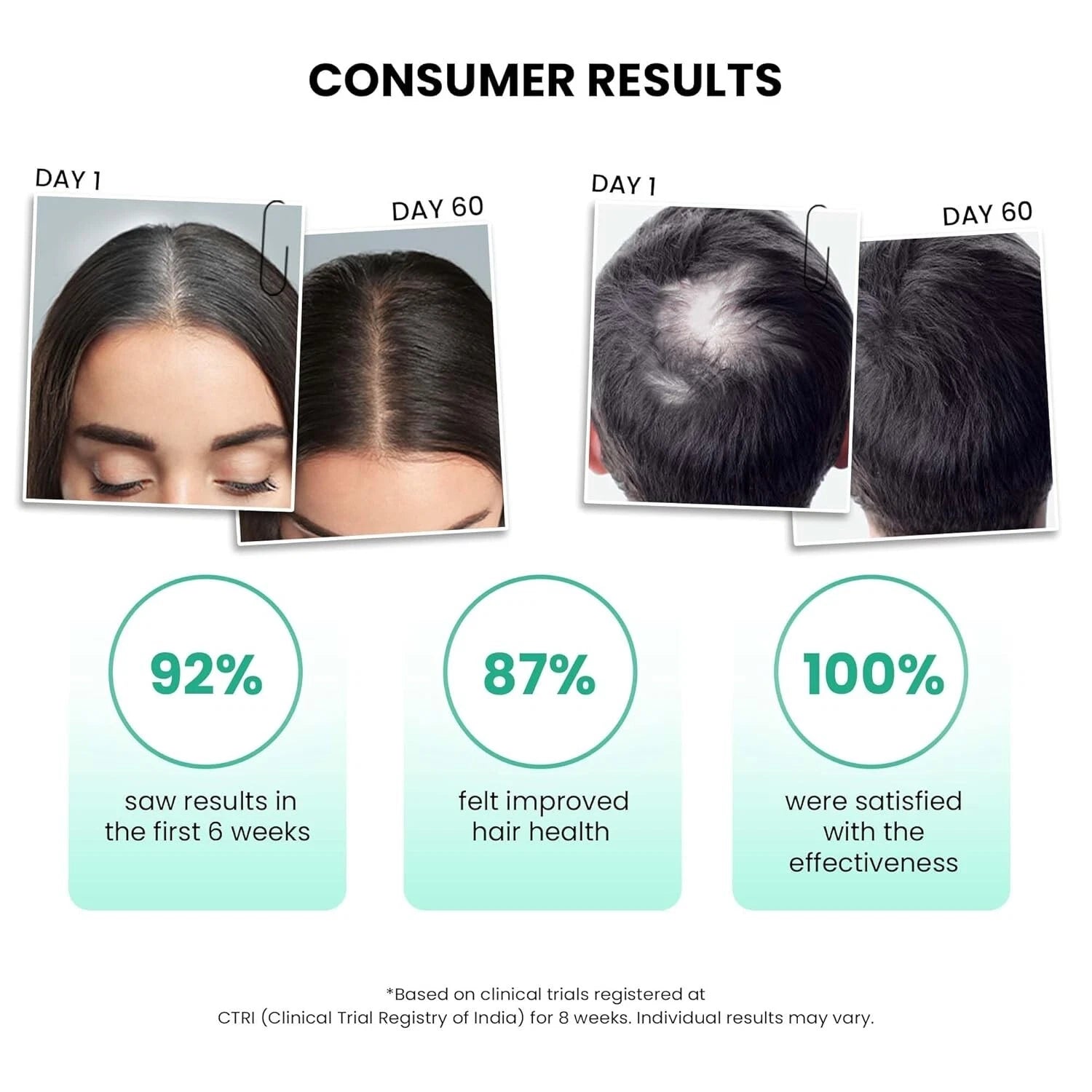 ThriveCo AntiGreying Hair Prime Serum - Reverses Premature Greying Colour ( 50ml )