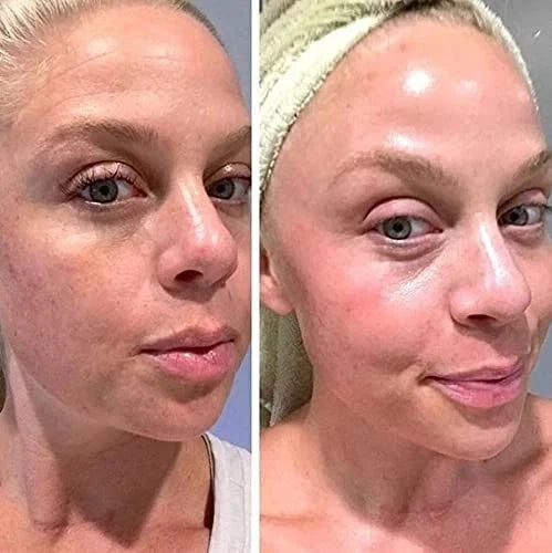 Retinol Gel 0.1 Vitamin a Repairs Fine Lines & Wrinkles, Scar Treatment, Age 20g